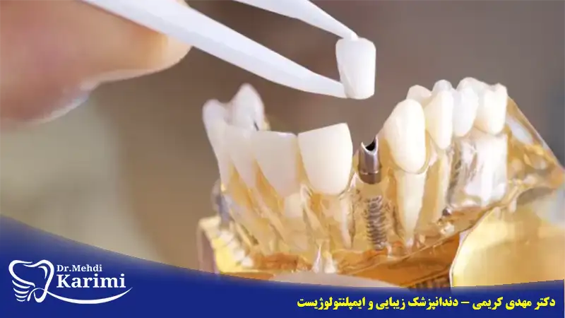 بهترین درمان بی دندانی