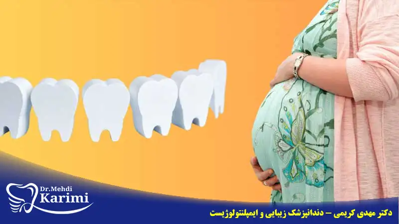 ایمپلنت دندان در بارداری